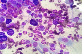 Approach to canine mast cell tumours and soft tissue sarcomas