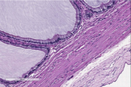 the-liver-enzymes-are-elevated-now-what-1.png