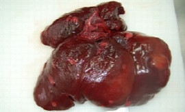 getting-the-most-out-of-a-liver-biopsy-1.jpeg