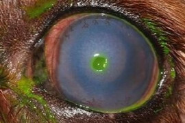 Uveitis - It's a Clinical Sign, Not A Diagnosis