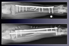 Simple Ways to treat Difficult Fractures in Dogs and Cats