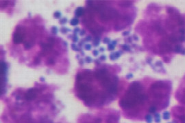 mrsa-mrsp-management-for-nurses-1.jpeg