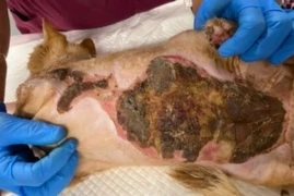 thermal-burn-injury300x200.jpg