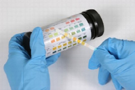 Urinalysis – a review (for veterinary nurses)