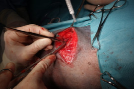 peri-operative-antimicrobial-use-2.jpeg